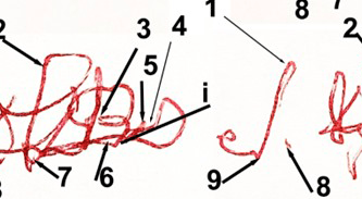 Experticia Grafotécnica