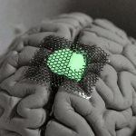 Implantes Cerebrales De Grafeno Superan Primer Ensayo Clínico Humano Inbrain Neuroelectronics