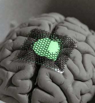 Implantes Cerebrales De Grafeno Superan Primer Ensayo Clínico Humano Inbrain Neuroelectronics