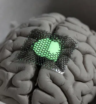 Implantes Cerebrales De Grafeno Superan Primer Ensayo Clínico Humano Inbrain Neuroelectronics