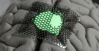 Implantes Cerebrales De Grafeno Superan Primer Ensayo Clínico Humano Inbrain Neuroelectronics