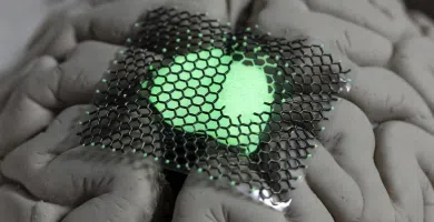 Implantes Cerebrales De Grafeno Superan Primer Ensayo Clínico Humano Inbrain Neuroelectronics